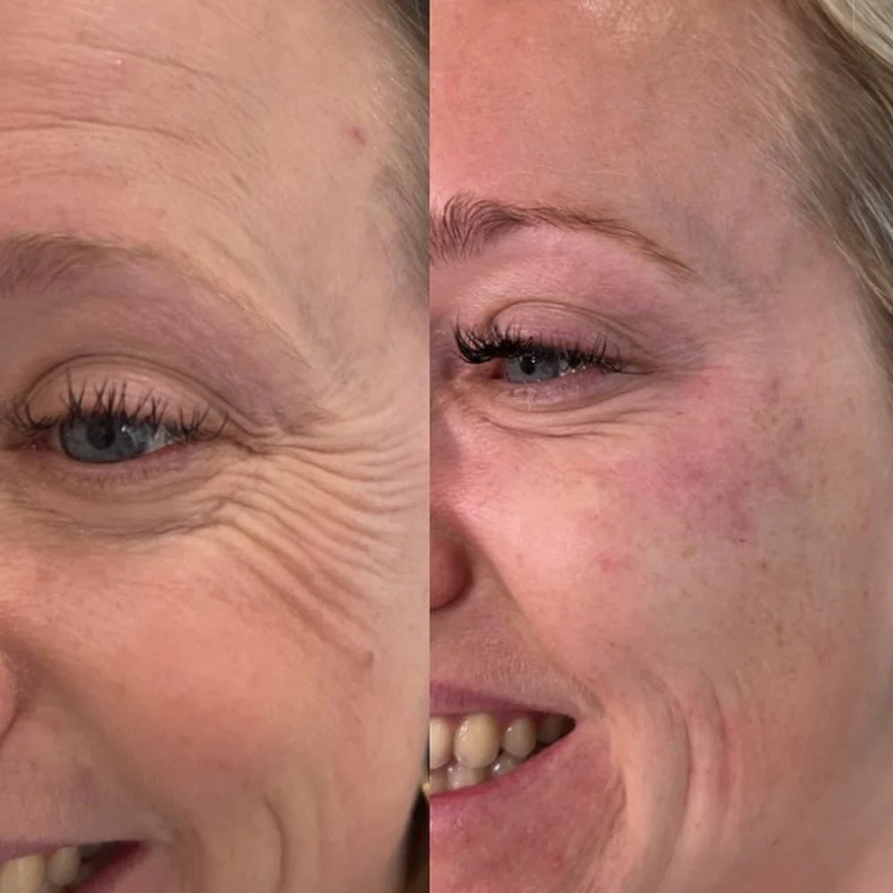 Parches Revitalizantes Para Ojos - Lieva