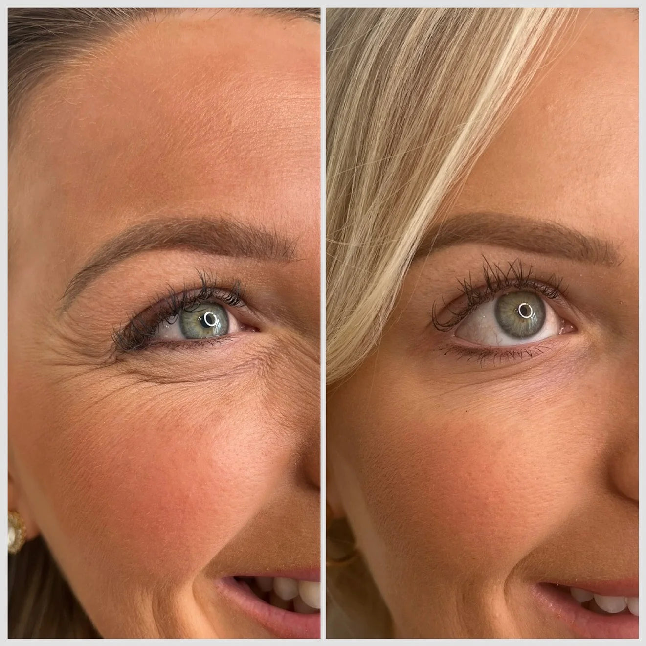 Parches Revitalizantes Para Ojos - Lieva