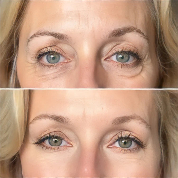 Parches Revitalizantes Para Ojos - Lieva