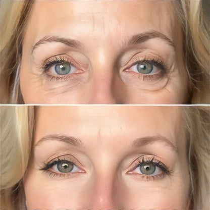 Parches Revitalizantes Para Ojos - Lieva