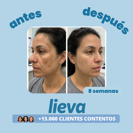 Lieva™ | Tratamiento para Manchas Oscuras